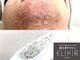 エリクサー 加須店(Elixir)の写真/頑固な強い毛がズバズバ抜ける!速攻性に自信あり!毎日の自己処理改善!脱毛専門店ならではの結果出しを是非!