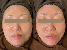 モモ(Momo.)/光フォト