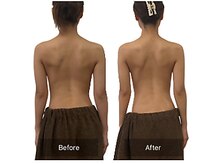 ベンザイ 梅田店(BENZAI)/スマホ首、リンパのつまり