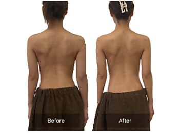 ベンザイ 梅田店(BENZAI)/スマホ首、リンパのつまり