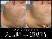 ビーエルティー(blt)/メンズレモンボトル