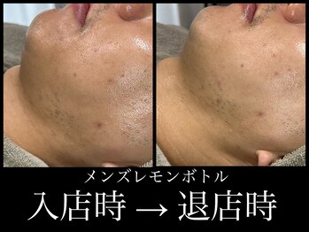 ビーエルティー(blt)/メンズレモンボトル