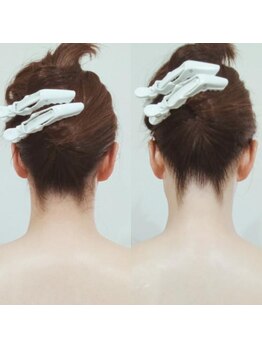 セレクトエステ シュエット(chouette)/襟深(うなじ)剃りbefore after