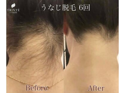 トリンテ バイ フェース(TRINTE by FAITH)の写真