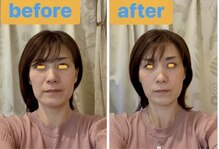 ぷらっと鍼灸院