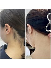 ミース 長野店/うなじ矯正◆ビフォーアフター