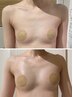 【バスト】バレずに豊胸！脂肪増加剤10ml業界初高濃度特許成分配合