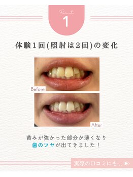 エクシアホワイトニング 阪急洛西口駅前店/1回でも変化を実感