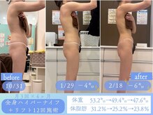 スリムプロ 天王寺店(Slimpro)/モニター様ビフォーアフター