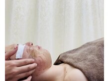 エール(Ailes)/ハーブピーリング 