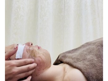 エール(Ailes)/ハーブピーリング