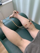 たまプラーザ駅前鍼灸整骨院/足の疲れ・スポーツのケガに！