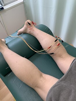 たまプラーザ駅前鍼灸整骨院/足の疲れ・スポーツのケガに!