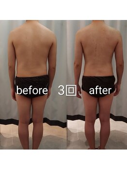 コリ チル(Kori Chill)/【ハイパーBefore→After】