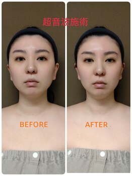 ドクタージェーナ(Dr.Jena)/お客様before/after