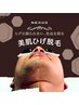 ＼青ヒゲ卒業しませんか？／ヒゲ脱毛で肌と時間が変わる！　¥6,600→