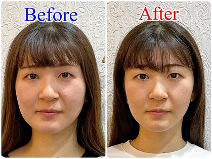 美容整体ウェリナ あま甚目寺院の写真