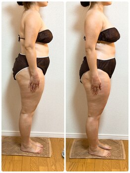 ソレイユ 北千住店(soleil)/全身の変化が分かる比較写真(2)