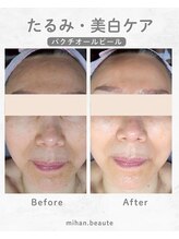 ミハン ボーテ(mihan.beaute)/