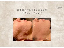 アミュレット(AMULET)の雰囲気（県内初！【プラソニック】プラズマの力でなめらか肌に）