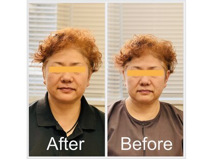 ビューティーパンク 黒田鍼治療院(Beauty Punc)の写真