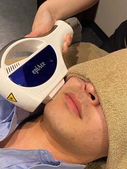 クレオ(CREO)/ひげ脱毛♪