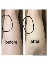 エムローズ(M.rose)/体質改善痩身★