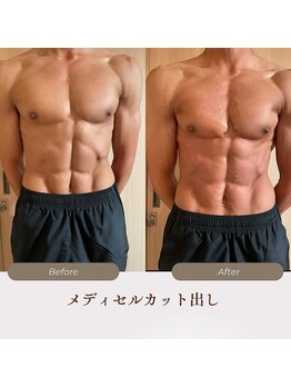 サロン ド メディセル(salon de Medicell)/メディセルでカット出し!!