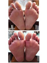 ノーブルフルール(Noble fleur)/ネイルと角質ケアと保湿がセット