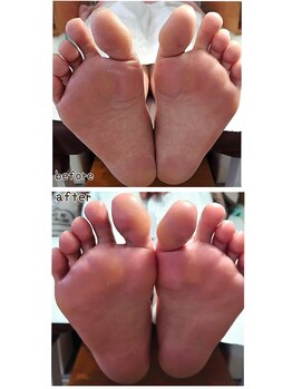 ノーブルフルール(Noble fleur)/ネイルと角質ケアと保湿がセット