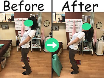 杉本接骨鍼灸院/首の痛み、背中の痛み、背骨矯正