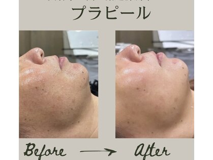ククルヘルスビューティー(CUCURU health×beauty)の写真