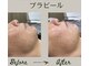 ククルヘルスビューティー(CUCURU health×beauty)の写真