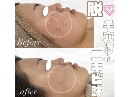 ミセル(MISEL2nd)の写真