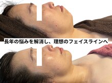 エニ(Eni)