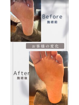 ジョガータ(jogata)/フットケア