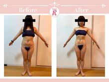 サロン アール(Salon R)/痩身施術×食事・インナーケア