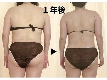 ディアメデル(Diamedel)/