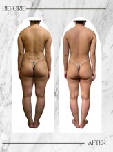 アンドエム(&M)&nbsp;美骨 メソッド