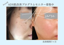 アルルプラス 山科(ARuru+)