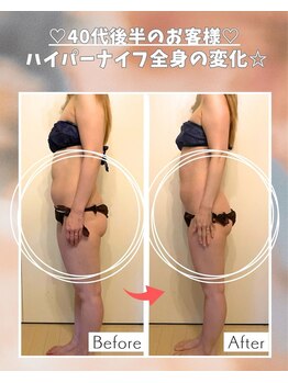 エステサロン 凛/お酒が好きだけどお腹も細く
