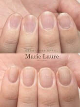 マリーロール 淀屋橋本店(Marie Laure)/自爪育成/深爪矯正/ネイルケア