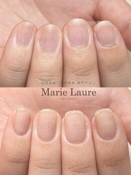 マリーロール 淀屋橋本店(Marie Laure)/自爪育成/深爪矯正/ネイルケア