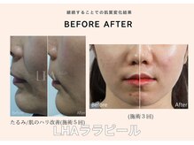 リジュベネーションサロン アリス(Alice)/ララピールB&A