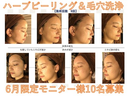 ヤワラ 長与店(yawara)の写真