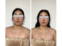 ルシアル(LUCIALL)/