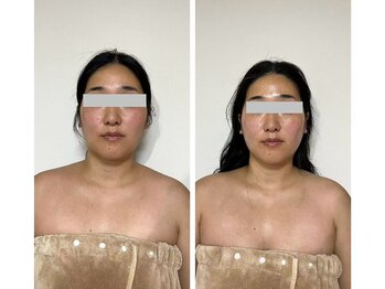 ルシアル(LUCIALL)/