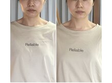 スマイル(smile)/before after 