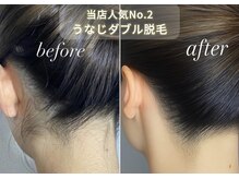 エピナス 大和店の雰囲気（デザイン込みワックス脱毛で、うなじ美人へ清潔感アップ！大和　）