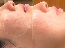 キュレイテッドスキン(CURATED SKIN)の雰囲気(人目を気にせずリラックスできる完全個室プライベートサロン◎)